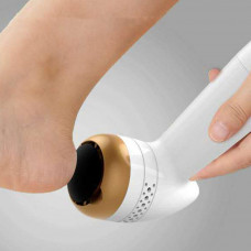 Foot File Callus Remover Electric Foot File Pedicure Exfoliating SP Foot File Callus Remover Electric Foot File Pedicure Exfoliating SP